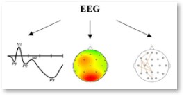 Gruppo-FOS_Ingegneria_Salute_Brain-Stroke-Monitoring-System_sistema-neurofisiologico