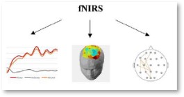 Gruppo-FOS_Ingegneria_Salute_Brain-Stroke-Monitoring-System_sistema-neurofisiologico_1